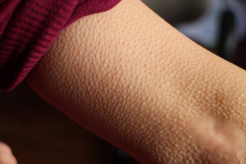 goosebumps on forearm with rolled up sleeves