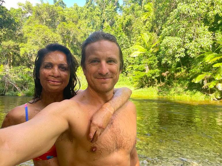 A man and a woman with burn marks taking a selfie in a lake, with bright green trees in the background.