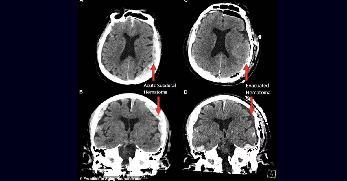 Pictured are CT scans of the patient, whose identity was not disclosed.