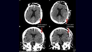 Pictured are CT scans of the patient, whose identity was not disclosed.