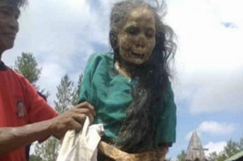 dead woman being walked by man