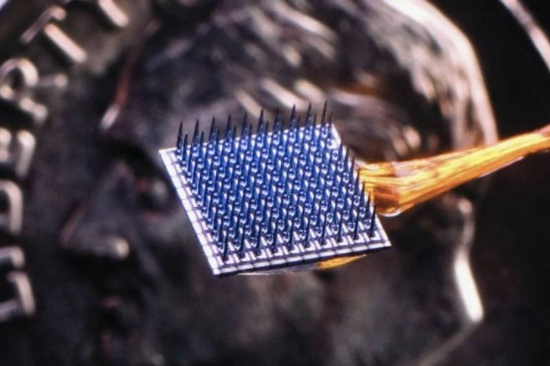 Brain-computer interface implant chip. ()