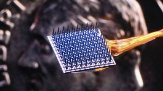 Brain-computer interface implant chip. ()