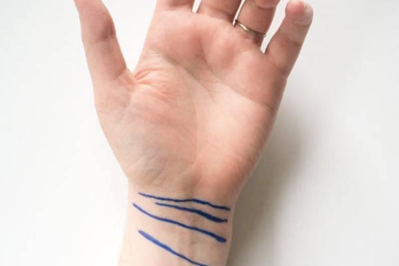 four lines on wrist in blue marker