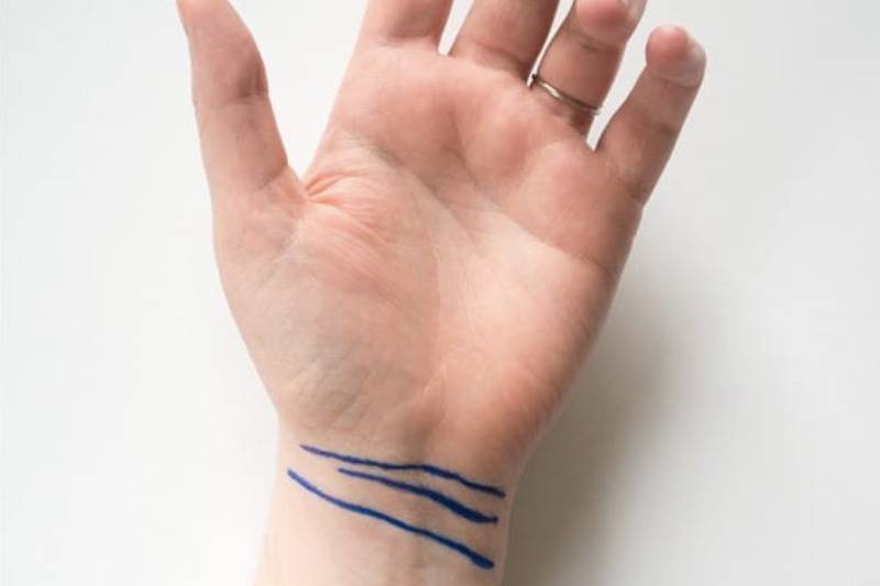 three lines on wrist in blue marker