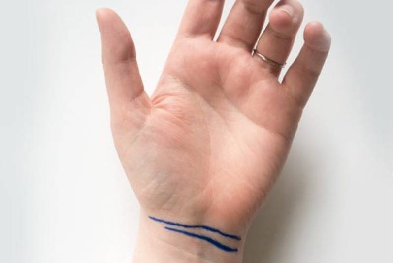 two lines on wrist in blue marker