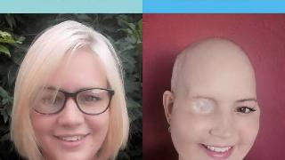 Toni before and after cancer side by side