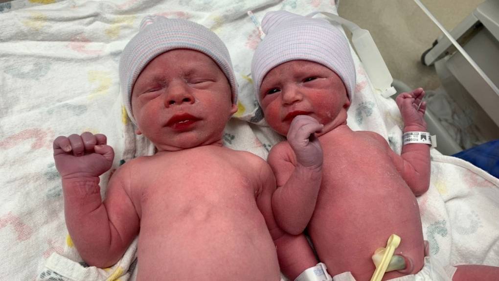 twins-lydia-and-timothy-at hospital at birth