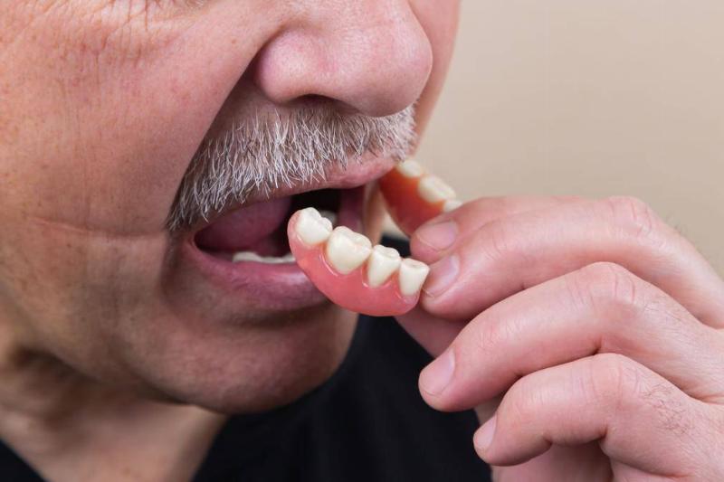 A man taking a set of dentures out of his mouth.