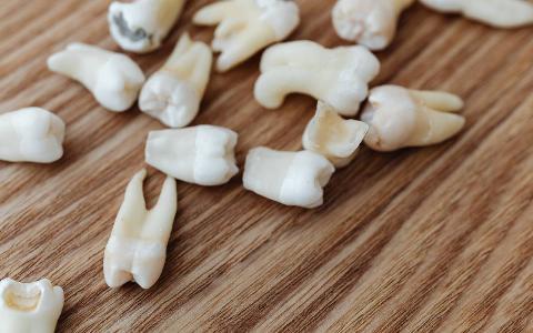 Loose teeth scattered on a table.