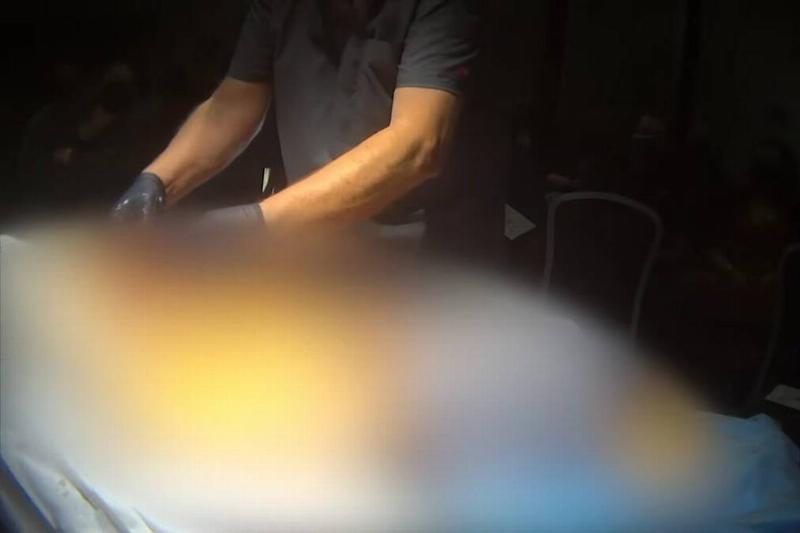 A blurred still from the livestreamed video of the dissection.