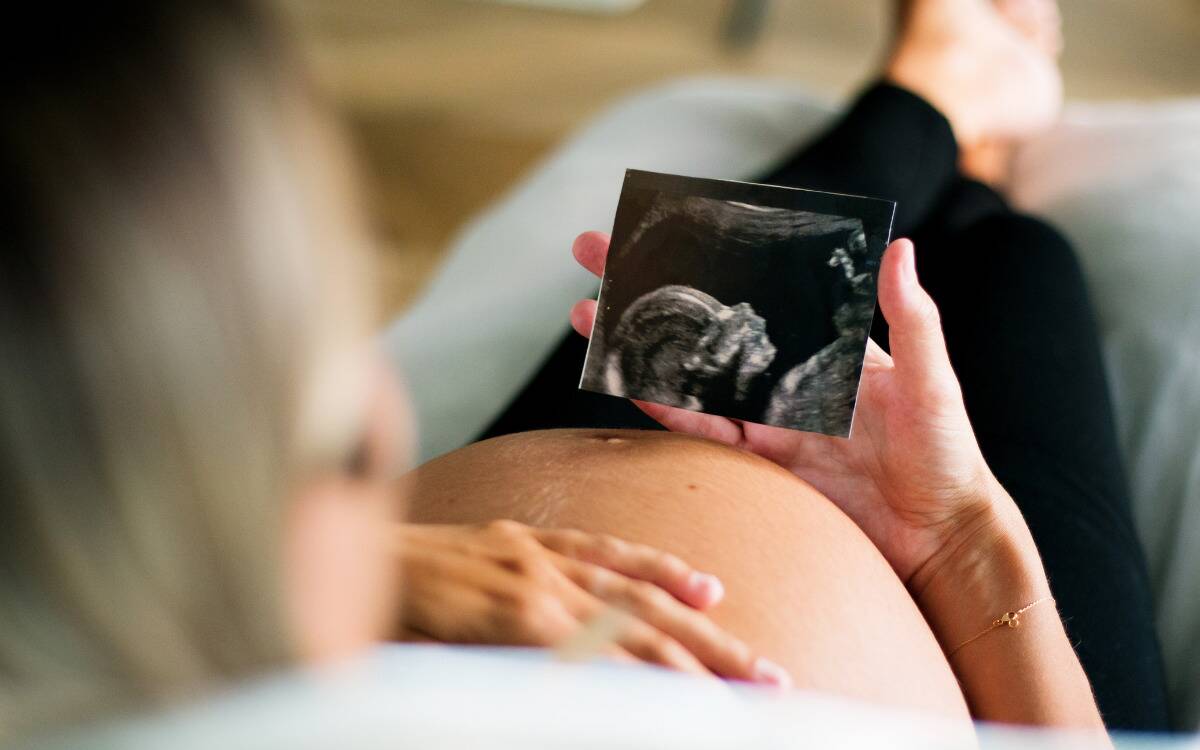 A pregnant woman holding a photo of her ultrasound above her bare belly.