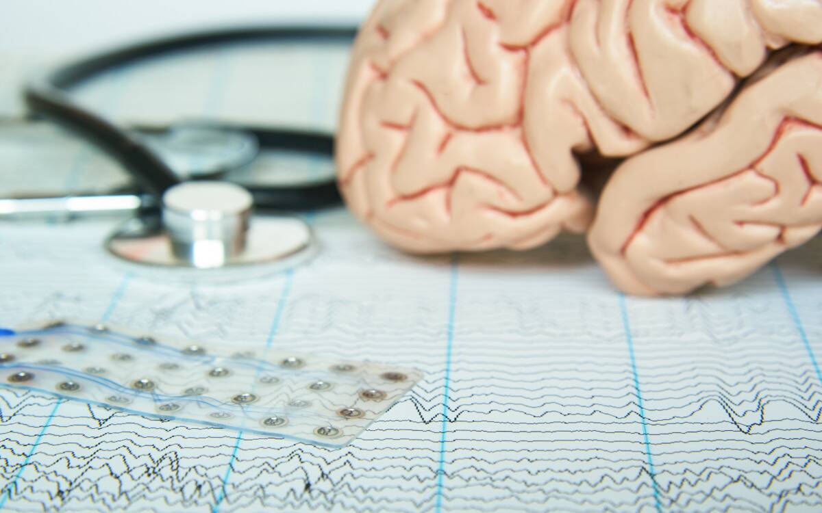 A model of a brain atop a sheet that recorded brain waves.
