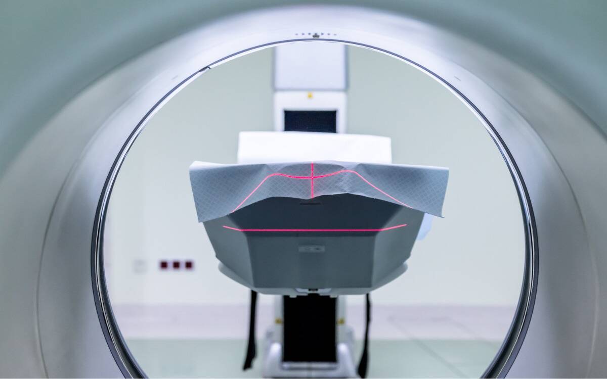 An MRI machine, photographed from the inside out.