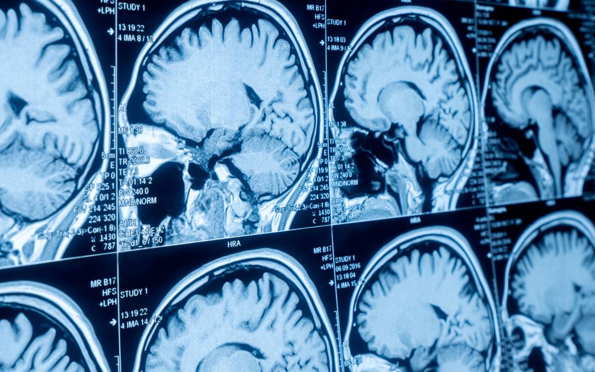 Closeups of a brain scan.