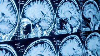 Closeups of a brain scan.