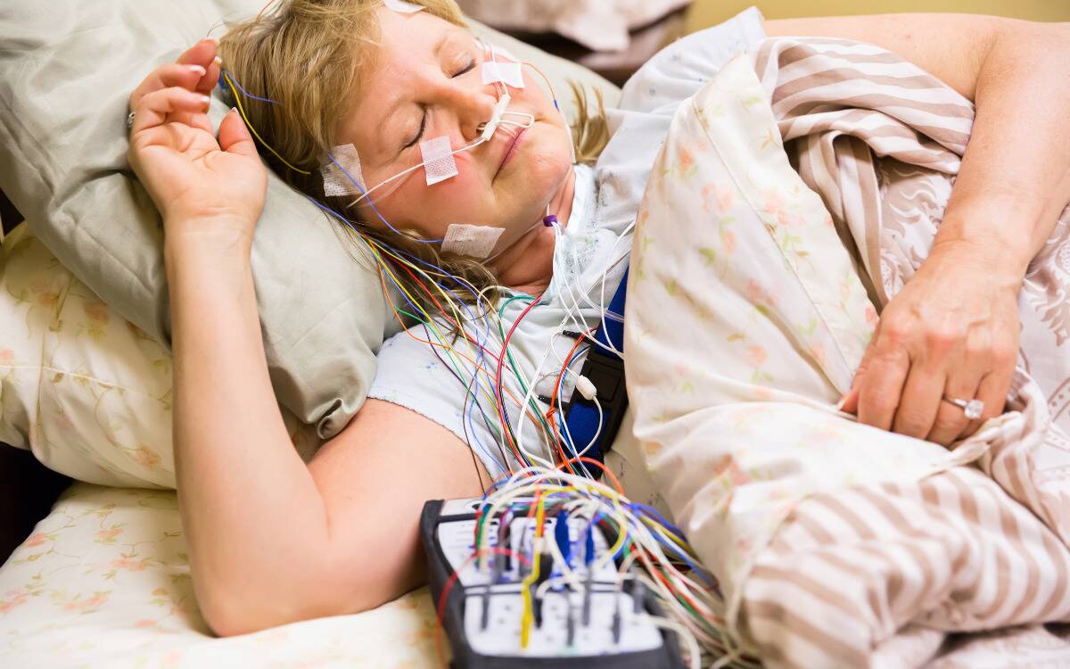 A woman hooked up a collection of wires for a sleep test, asleep in bed.