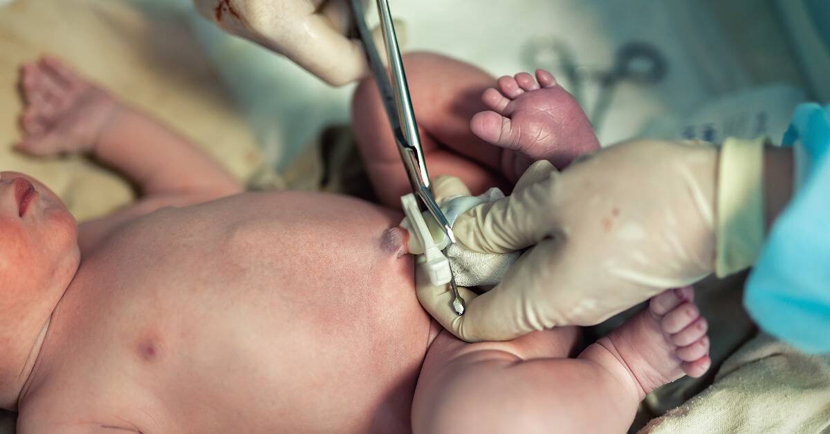 A nurse cutting a baby's umbillical cord.