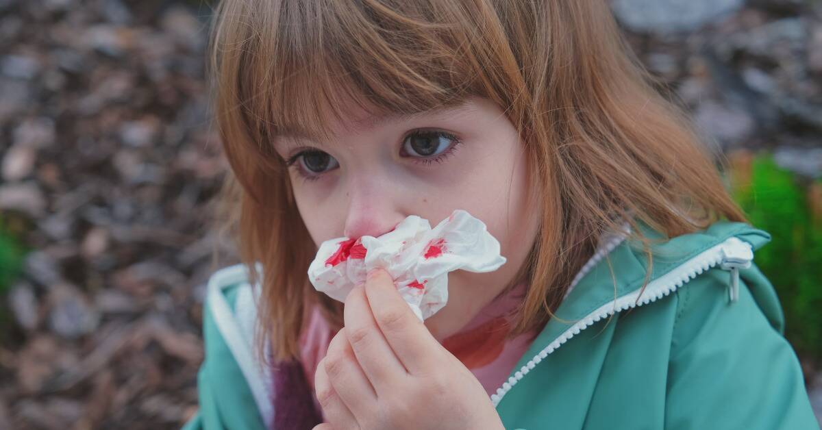 A young girl holding a bloody tissue to her nose.