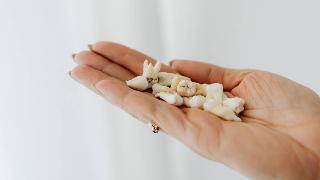 A hand holding some loose teeth, mostly molars.