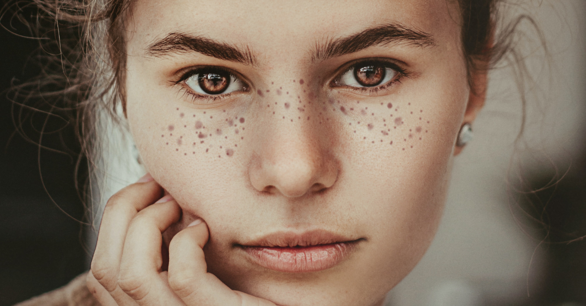 close up of the face of woman with freckles with brown eyes