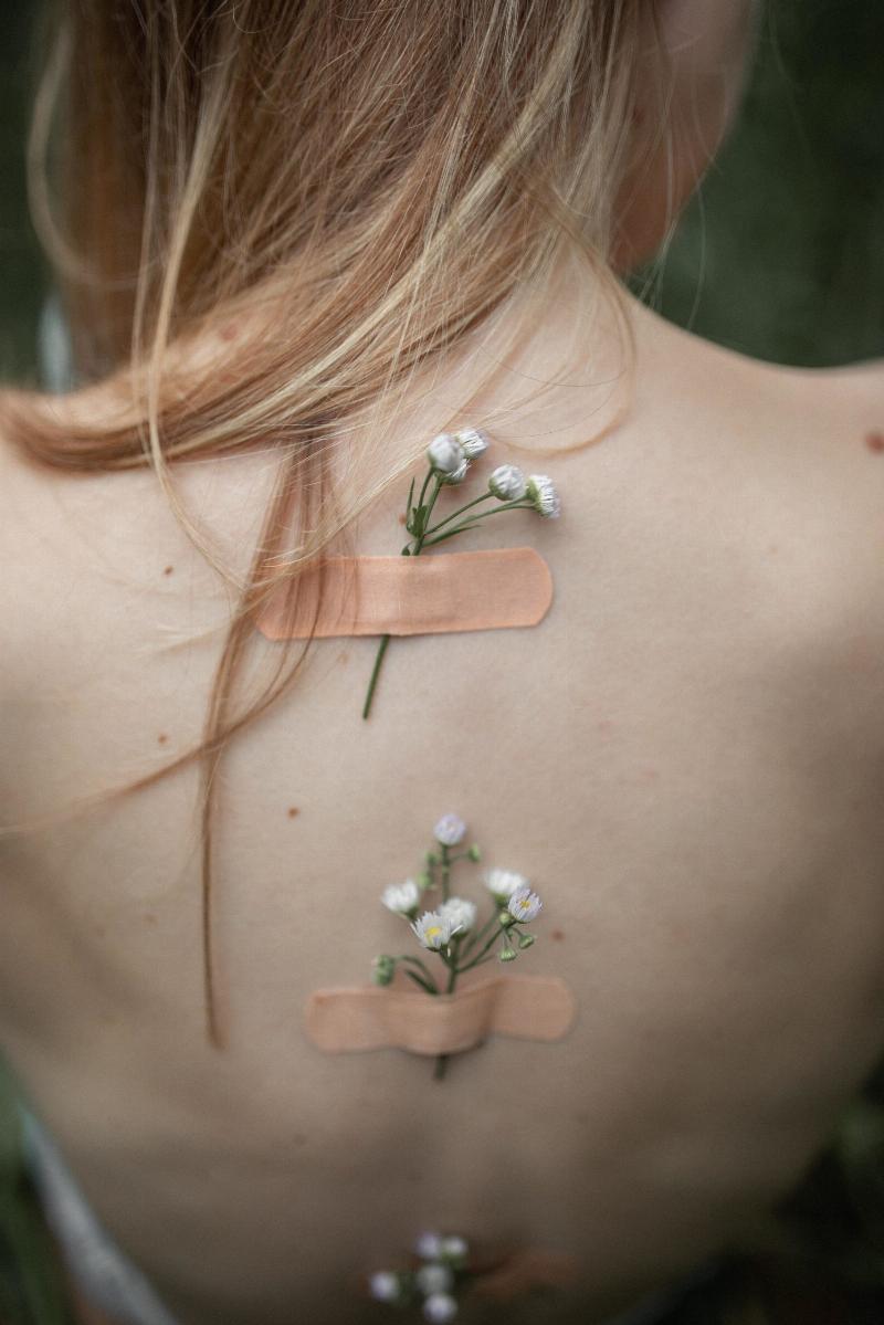 bandaids over flowers on woman's backs