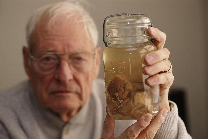 Pathologist Thomas Harvey (1912 - 2007) holds the brain of theoretical physicist Albert Einstein in a jar, Kansas, 1994. Harvey performed the autopsy on Einstein in 1955, and retained parts of the brain for scientific study.
