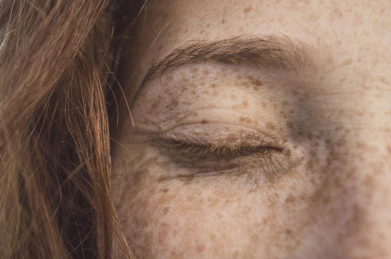 close up of woman face's with eyes closed and covered in freckles