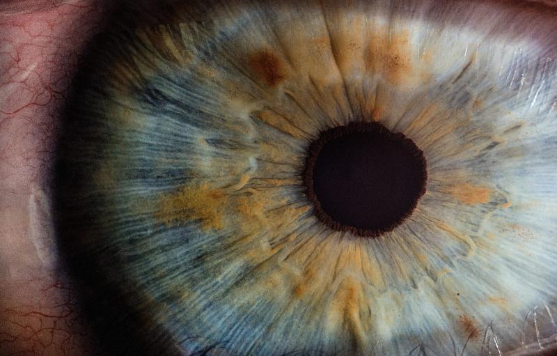 Close up of an eye with pupil dialiting
