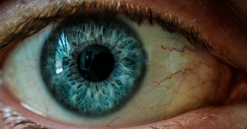 close up of dialated blue eye