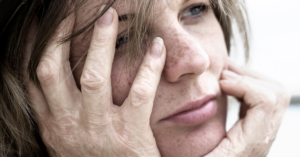 woman with scarred hands