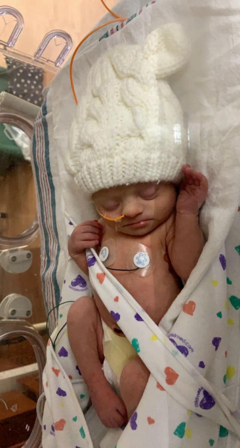 baby hooked to wires in hospital and sleeping